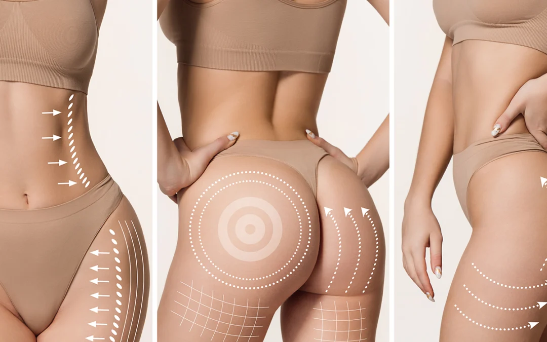 Myths and Facts about Body Contouring